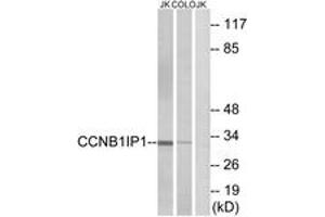 Western Blotting (WB) image for anti-Cyclin B1 Interacting Protein 1 (CCNB1IP1) (AA 201-250) antibody (ABIN2890282) (CCNB1IP1 抗体  (AA 201-250))
