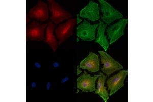 ABIN6256935 and ABIN6274838 staining  cells by IF/ICC. (Amphiphysin 抗体  (Internal Region))