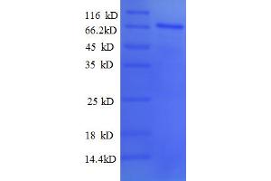 SDS-PAGE (SDS) image for Paired Box Gene 2a (PAX2A) (AA 1-363), (partial) protein (GST tag) (ABIN5712780) (PAX2A Protein (AA 1-363, partial) (GST tag))