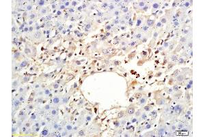 Formalin-fixed and paraffin embedded rat liver labeled with Anti-ARP4 Polyclonal Antibody, Unconjugated (ABIN708581) at 1:200 followed by conjugation to the secondary antibody (BAF53A 抗体  (AA 331-410))