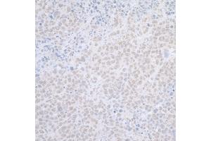anti-ElaC Homolog 2 (ELAC2) (AA 150-200) antibody