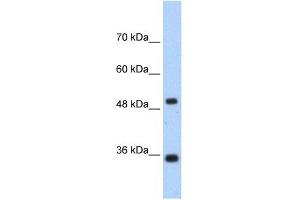 FBP1 antibody used at 1. (FBP1 抗体  (N-Term))
