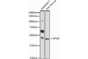 Western blot analysis of extracts of various cell lines, using WTAP antibody (ABIN7271372) at 1:1000 dilution. (WTAP 抗体  (AA 1-396))