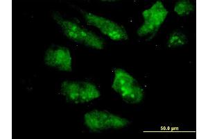 Immunofluorescence of monoclonal antibody to EIF2AK2 on HeLa cell. (EIF2AK2 抗体  (AA 1-100))