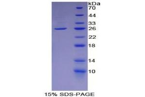 SDS-PAGE of Protein Standard from the Kit (Highly purified E. (L1CAM ELISA 试剂盒)