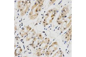 Immunohistochemistry (IHC) image for anti-Small Nuclear Ribonucleoprotein Polypeptide E (SNRPE) antibody (ABIN1876676) (SNRPE 抗体)