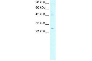 ACDC antibody used at 5 ug/ml to detect target protein. (ADIPOQ 抗体  (N-Term))