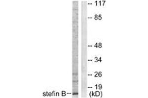 Western blot analysis of extracts from A549 cells, using Stefin B Antibody. (CSTB 抗体  (AA 49-98))