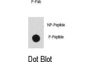 Image no. 2 for anti-BCL2-Associated Agonist of Cell Death (BAD) (pSer99) antibody (ABIN358087)