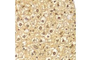 Immunohistochemistry of paraffin-embedded mouse liver using PYCARD antibody at dilution of 1:100 (400x lens). (STS 抗体)