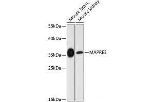 Western blot analysis of extracts of various cell lines using MAPRE3 Polyclonal Antibody at dilution of 1:3000. (MAPRE3 抗体)