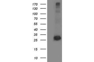 Western Blotting (WB) image for anti-Sirtuin 5 (SIRT5) antibody (ABIN1500931)