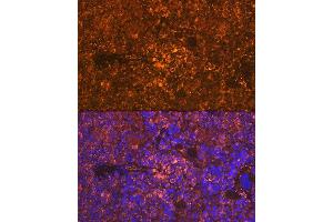 Immunofluorescence analysis of rat spleen using Oncostatin M Rabbit mAb (ABIN7269099) at dilution of 1:100 (40x lens). (Oncostatin M 抗体)