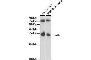 Western blot analysis of extracts of various cell lines, using LY86 antibody (ABIN6128208, ABIN6143395, ABIN6143396 and ABIN6221778) at 1:1000 dilution. (LY86 抗体  (AA 21-162))