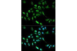 Immunofluorescence analysis of HepG2 cell using ADH5 antibody. (ADH5 抗体)