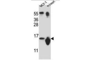 SNRPD3 Antibody (N-term) western blot analysis in MCF-7 cell line ans mouse heart tissue lysates (35µg/lane). (SNRPD3 抗体  (N-Term))