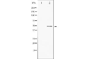Western Blotting (WB) image for anti-Activating Transcription Factor 2 (ATF2) (pSer44), (pSer62) antibody (ABIN6255342)