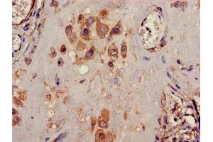 Immunohistochemistry of paraffin-embedded human placenta tissue using ABIN7163916 at dilution of 1:100 (KCNK1 抗体  (AA 268-336))