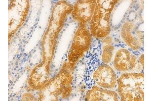 ABIN6263116 and ABIN6266862 at 1/100 staining human normal kidney tissue by IHC-P. (ERK1 抗体  (C-Term))