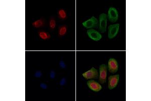 ABIN7094603 and ABIN7098653 staining Hela cells by IF/ICC.