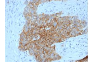Immunohistochemistry (IHC) image for anti-Solute Carrier Family 2 (Facilitated Glucose Transporter), Member 1 (SLC2A1) (AA 203-305) antibody (ABIN6940594)