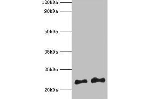 Western blot All lanes: Hras antibody at 2 μg/mL Lane 1: 293T whole cell lysate Lane 2: Mouse brain tissue Secondary Goat polyclonal to rabbit IgG at 1/10000 dilution Predicted band size: 22 kDa Observed band size: 22 kDa (HRAS 抗体  (AA 2-186))