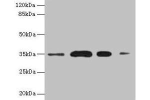 Western blot All lanes: SULT1A3 antibody at 20 μg/mL Lane 1: A549 whole cell lysate Lane 2: Colo320 whole cell lysate Lane 3: Mouse brain tissue Lane 4: Mouse kidney tissue Secondary Goat polyclonal to rabbit IgG at 1/10000 dilution Predicted band size: 35, 23 kDa Observed band size: 35 kDa (SULT1A3 抗体  (AA 1-295))