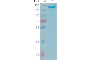 SDS-PAGE (SDS) image for Complement Factor H (CFH) (AA 19-1231) protein (His tag) (ABIN7538204)