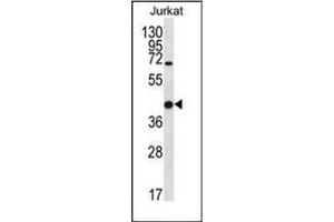 Western blot analysis of Galectin-4 Antibody (N-term) in Jurkat cell line lysates (35ug/lane). (GAL4 抗体  (N-Term))