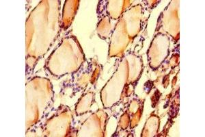 Immunohistochemistry of paraffin-embedded human thyroid tissue using ABIN7158488 at dilution of 1:100 (LONP1 抗体  (AA 614-959))