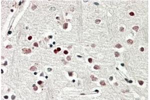 AP20177PU-N SOX3 Antibody staining of paraffin embedded Human Cerebral Cortex at 3. (SOX3 抗体  (C-Term))