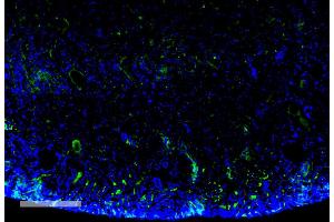 Immunohistochemistry analysis using Mouse Anti-Malondialdehyde Monoclonal Antibody, Clone 11E3 (ABIN5067371). (Malondialdehyde 抗体  (APC))