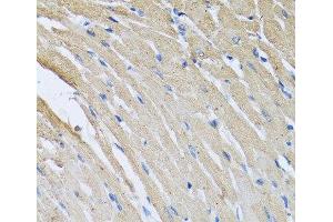 Immunohistochemistry of paraffin-embedded Rat heart using CRHBP Polyclonal Antibody at dilution of 1:100 (40x lens). (CRHBP 抗体)