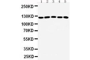 Western Blotting (WB) image for anti-Suppression of Tumorigenicity 5 (ST5) (AA 571-586), (Middle Region) antibody (ABIN3042548) (ST5 抗体  (Middle Region))