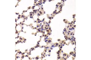 Immunohistochemistry of paraffin-embedded Mouse lung using PYGL antibody at dilution of 1:100 (x400 lens). (PYGL 抗体)
