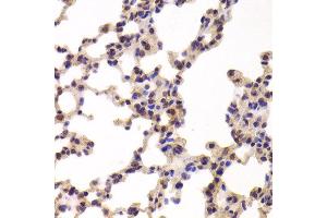 Immunohistochemistry of paraffin-embedded Mouse lung using PYGL antibody at dilution of 1:100 (x400 lens).
