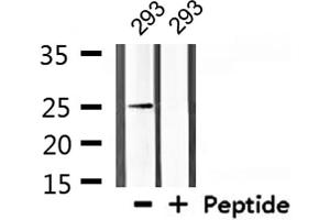 Western blot analysis of extracts from 293, using Claudin 10 Antibody. (CLDN10 抗体  (C-Term))