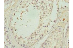Immunohistochemistry of paraffin-embedded human testis tissue using ABIN7146346 at dilution of 1:100 (CALCOCO1 抗体  (AA 462-691))
