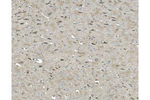 IHC analysis of ULK1 using anti-ULK1 antibody (ABIN7602755).