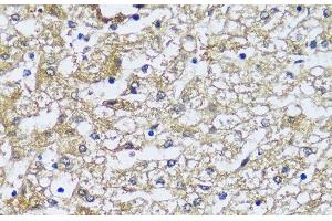 Immunohistochemistry of paraffin-embedded Human liver using NQO2 Polyclonal Antibody at dilution of 1:100 (40x lens). (NQO2 抗体)