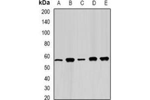 Western blot analysis of FAAH expression in Jurkat (A), Hela (B), mouse kidney (C), PC12 (D), COS7 (E) whole cell lysates. (FAAH 抗体)