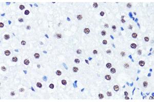 Immunohistochemistry of paraffin-embedded Rat liver using Symmetric DiMethyl-Histone H3-R2 Polyclonal Antibody at dilution of 1:100 (40x lens). (Histone 3 抗体  (H3R2me2s))