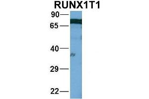 Host:  Rabbit  Target Name:  WT1  Sample Type:  721_B  Antibody Dilution:  1. (RUNX1T1 抗体  (Middle Region))