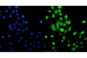 IF analysis of MCM5 using anti-MCM5 antibody (ABIN7600583).