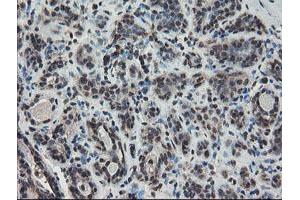 Immunohistochemical staining of paraffin-embedded Human breast tissue using anti-TDO2 mouse monoclonal antibody. (TDO2 抗体)
