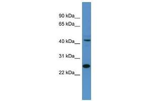 Tfdp1 antibody used at 0. (DP1 抗体  (N-Term))