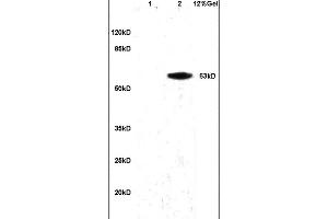 Lane 1: mouse brain lysates Lane 2: human colon carcinoma lysates probed with Anti alpha Actinin PGRN/Granulin Polyclonal Antibody, Unconjugated (ABIN728668) at 1:200 in 4 °C. (Granulin 抗体  (AA 451-550))