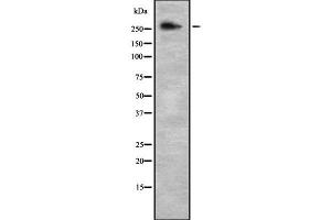 Western blot analysis NCOR2 using NIH-3T3 whole cell lysates (NCOR2 抗体  (C-Term))