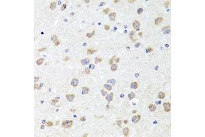 Immunohistochemistry of paraffin-embedded mouse brain using CHD1 antibody (ABIN5975217) at dilution of 1/100 (40x lens). (CHD1 抗体)