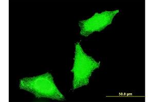 Immunofluorescence of monoclonal antibody to PPP1R2P3 on HeLa cell. (PPP1R2P3 抗体  (AA 1-205))
